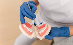 full arch dental implant