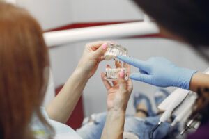 strong are dental implants