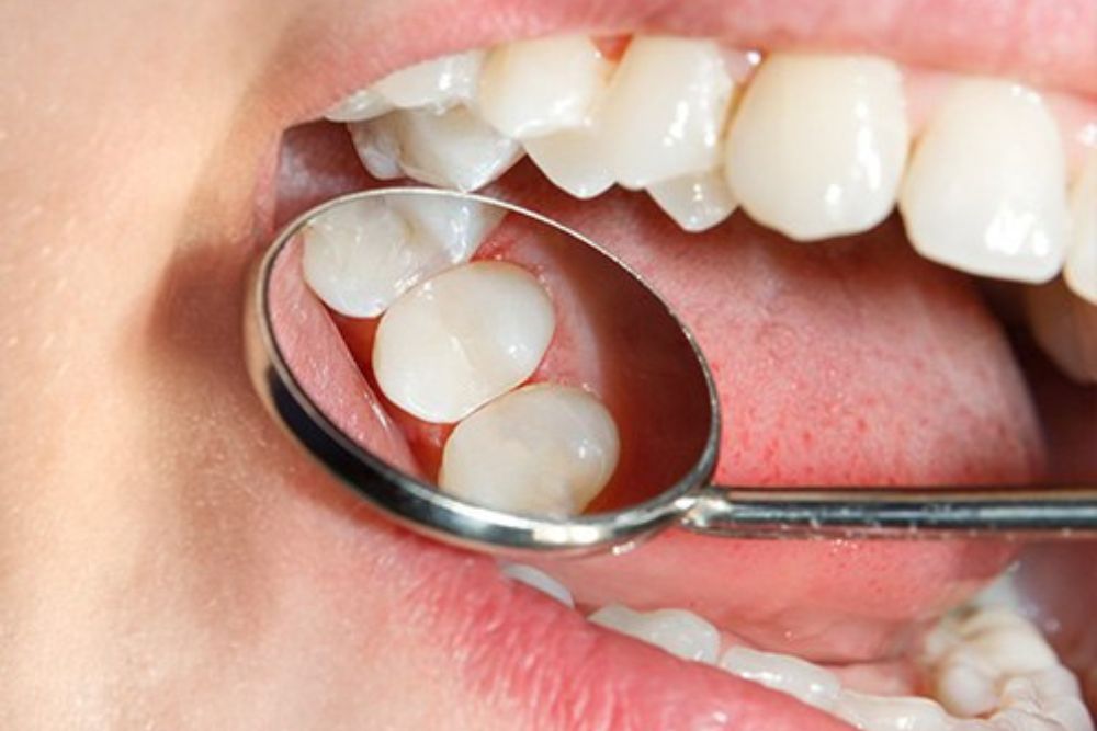 emergency dentist West Hollywood same day