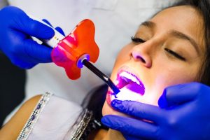 dental sealants work to protect teeth