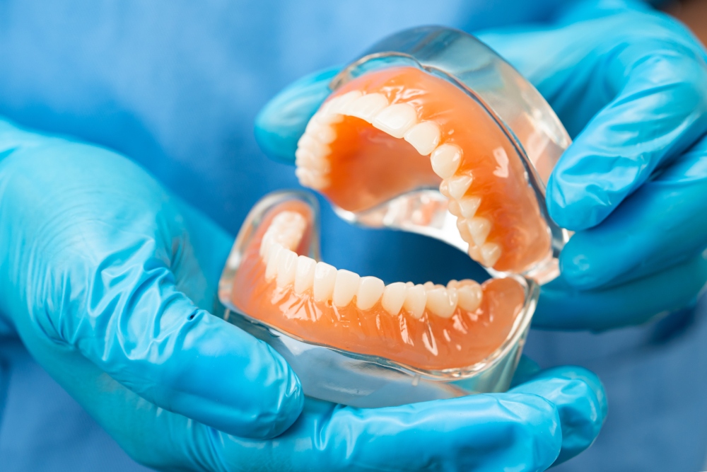 implant supported dentures