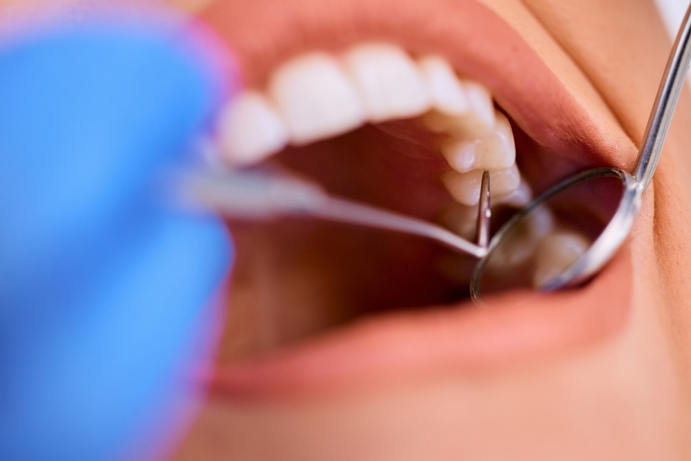 dental filling dentistry